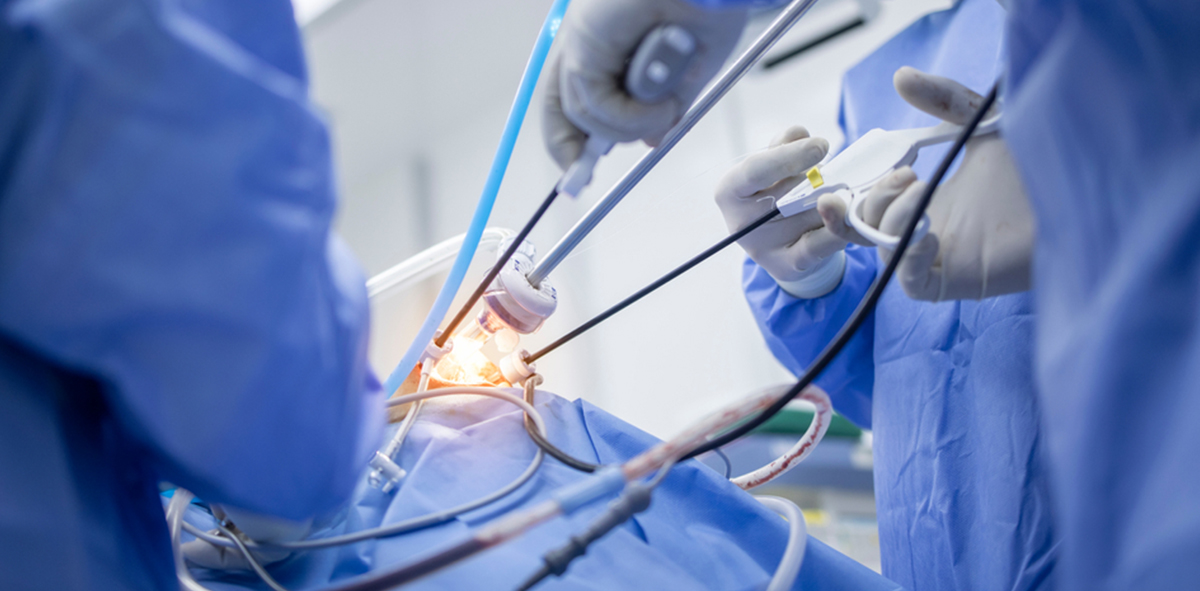 Minimally Invasive Cardiac Surgery